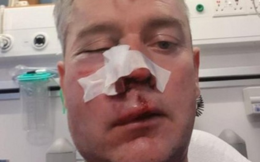 В Ирландии футболисты и болельщики избили судью, сломав ему челюсть