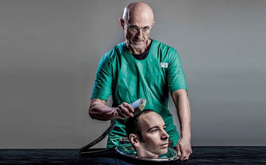 ​Хирурги закончили подготовку к операции по пересадке головы человеку