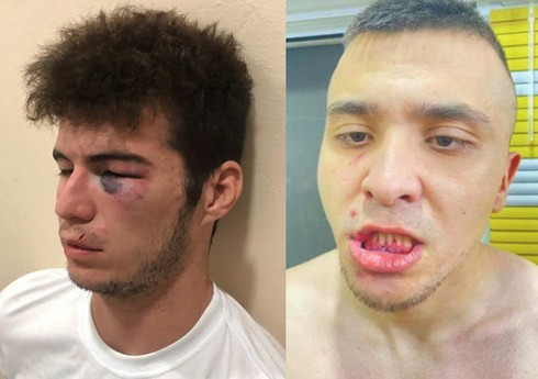 Инцидент в узбекском клубе: Игроков избили битами за просьбу выплатить зарплату