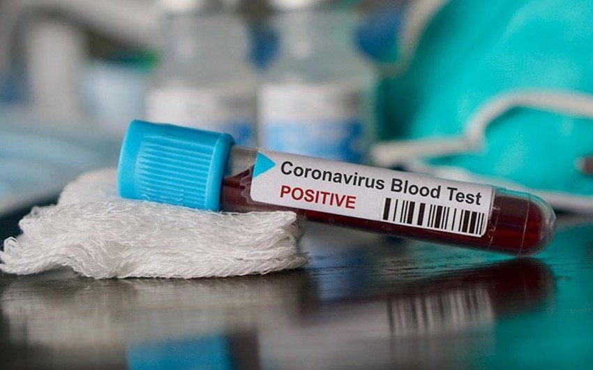 Bakı, Sumqayıt və Abşeronda koronavirusa yoluxanların sayı açıqlandı