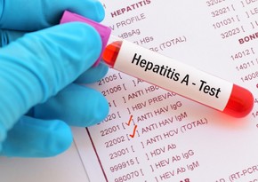 Health Ministry's expert: Hepatitis A does not cause chronic liver diseases