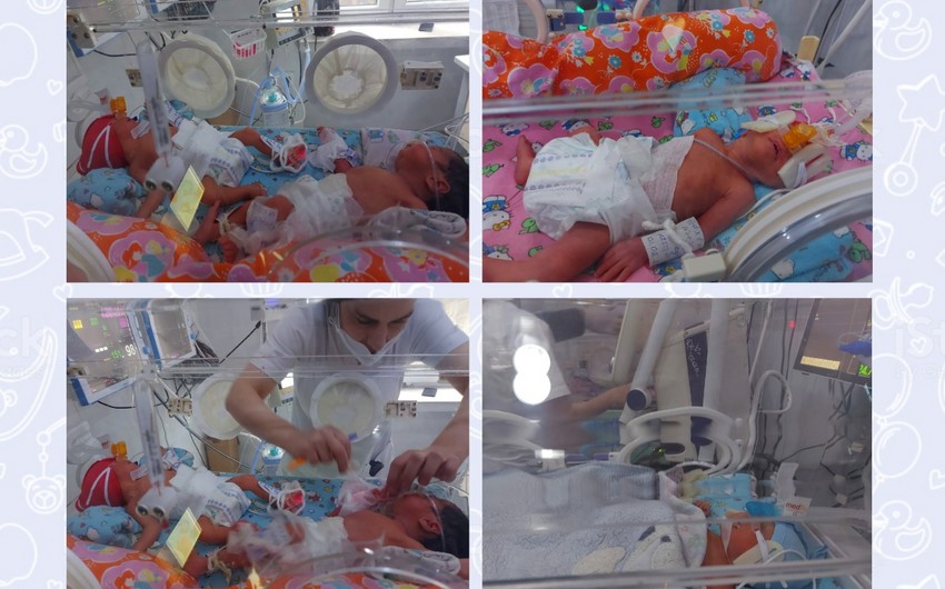 В Баку две заразившиеся COVID-19 женщины родили тройняшек и четверняшек 