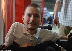 36-hour head transplant of 11 million USD to be carried out in China in 2017