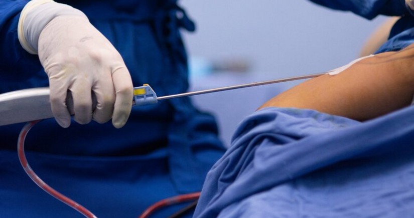 Sumqayıtda 34 yaşlı qadın liposaksiyadan sonra ölüb