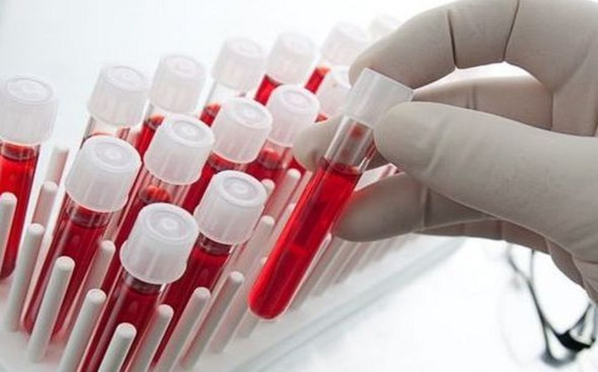 Взяты образцы крови у прибывших в Азербайджан лиц, у которых имеется подозрение на заражение свиным гриппом