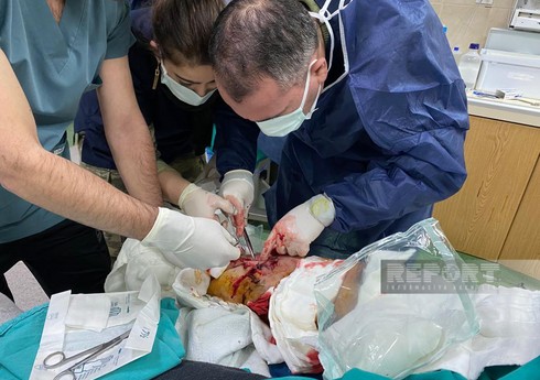 Азербайджанские врачи принимают активное участие в эвакуации пострадавших в ходе землетрясения в Турции 