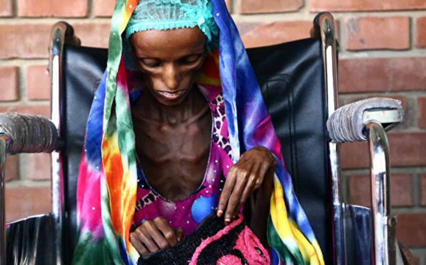 ООН: В Йемене голод угрожает 17 миллионам человек
