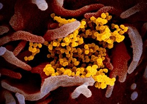 Coronavirus-infected human cell - PHOTO