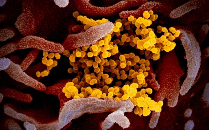 Coronavirus-infected human cell - PHOTO