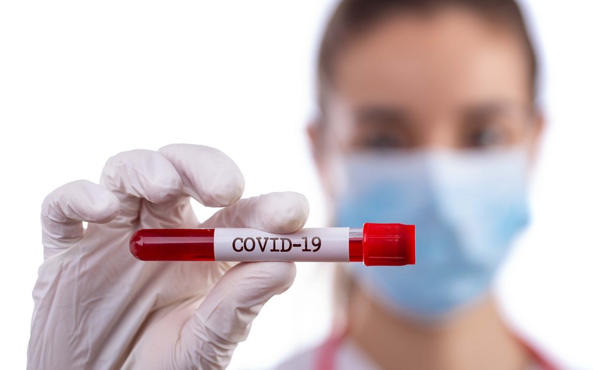 Azərbaycanda daha 1 880 nəfər koronavirusa yoluxub, 27 nəfər ölüb