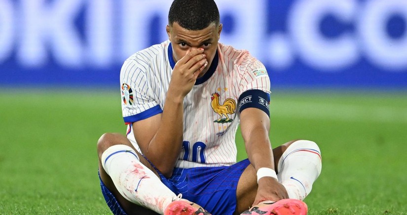 Kylian Mbappe could miss rest of Euro 2024 group stage due to broken nose