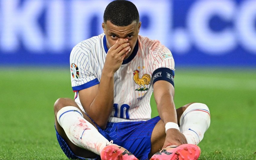 Kylian Mbappe could miss rest of Euro 2024 group stage due to broken nose