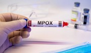 Red Cross: Africa's mpox epidemic requires global response