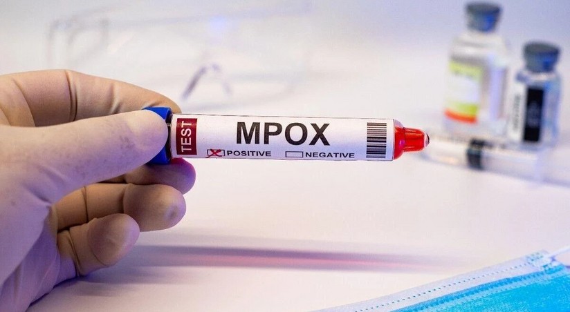 Red Cross: Africa's mpox epidemic requires global response | Report.az