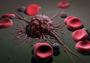 Ученые нашли способ побороть метастазы рака