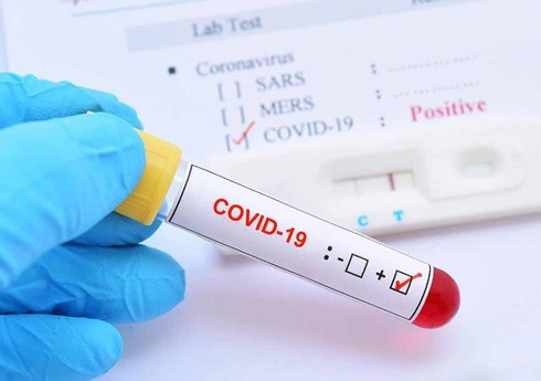 В Азербайджане зарегистрировано 29 новых случаев заражения коронавирусом