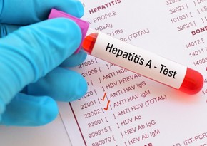 Azərbaycanda Hepatit A virusu ilə bağlı son vəziyyət açıqlanıb