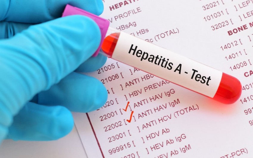 Azərbaycanda Hepatit A virusu ilə bağlı son vəziyyət açıqlanıb