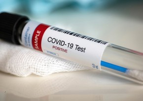 Azerbaijani official infected with coronavirus