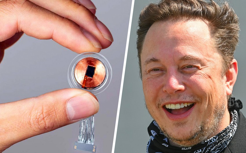 Elon Musk's brain chip firm receives approval to launch first-in-human clinical study