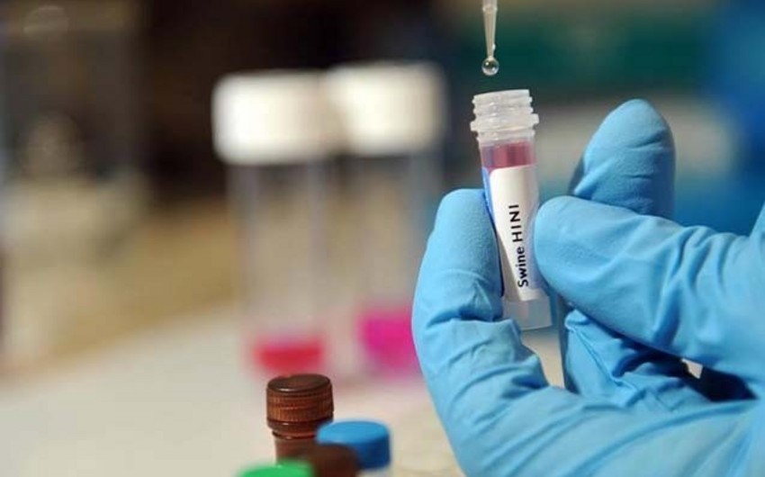 В Армении зафиксирован еще один случай смерти от свиного гриппа