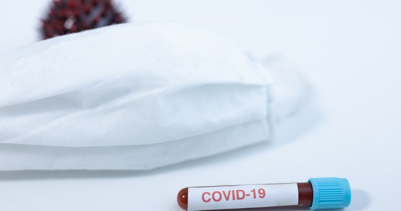 Azərbaycanda daha 22 nəfər koronavirusa yoluxub, 5 nəfər ölüb
