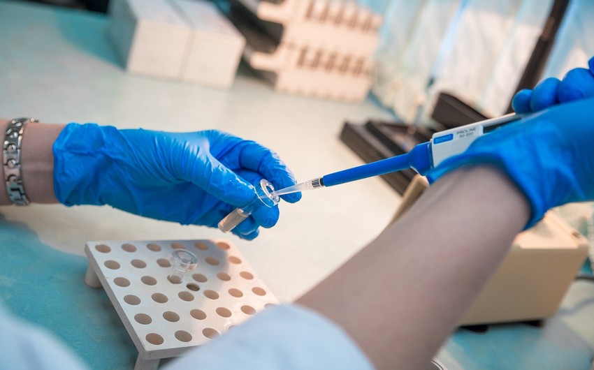 В Японии создали тест, позволяющий за 30 минут выявить коронавирус