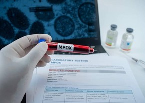 В ЮАР за июнь зафиксировали третью смерть от mpox
