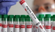 В Африке выявили более 35 тыс. случаев с подозрением на mpox с начала года