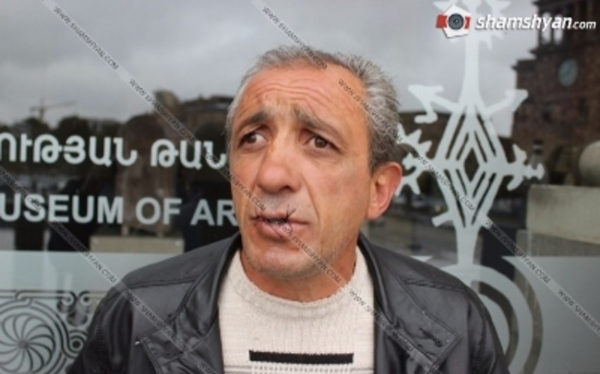 В Ереване мужчина в знак протеста зашил себе рот
