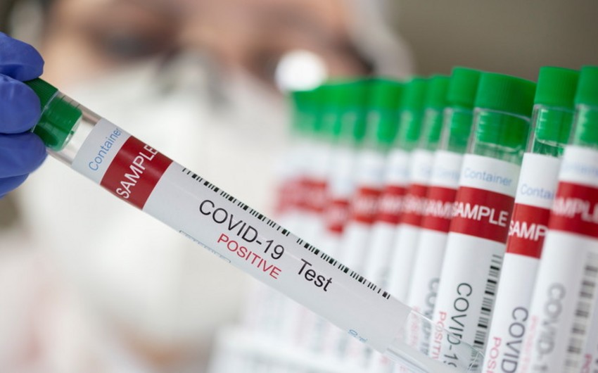 Kolumbiyada son sutkada 25 mindən çox koronavirus yoluxması aşkarlanıb