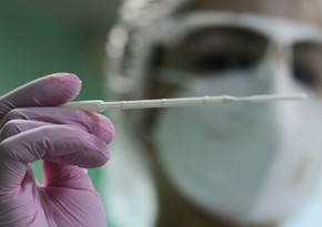 Azərbaycanda daha  4 387 nəfər koronavirusa yoluxub, 38 nəfər ölüb