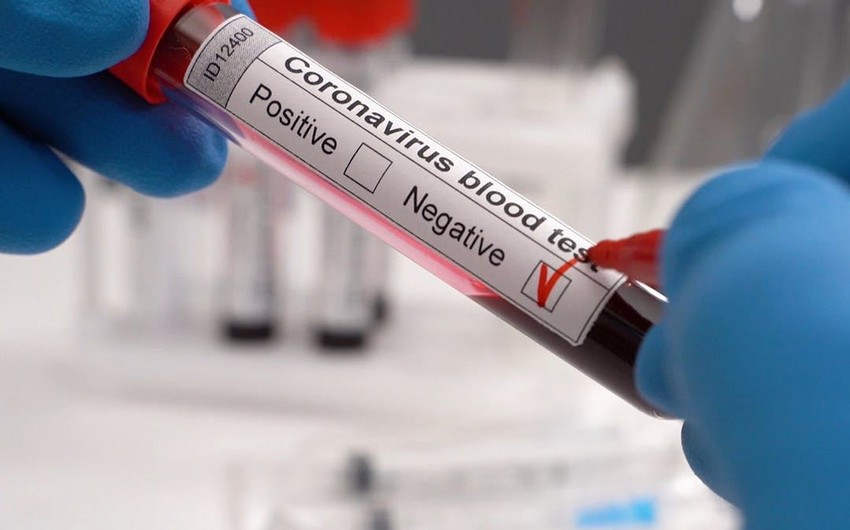İnfeksionist: “Azərbaycanda koronavirusa yenidən kütləvi yoluxma ehtimalı hələlik yoxdur”