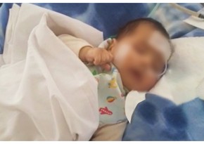 В Баку спасли жизнь 3-месячному ребенку, находившемуся неделю в коме 
