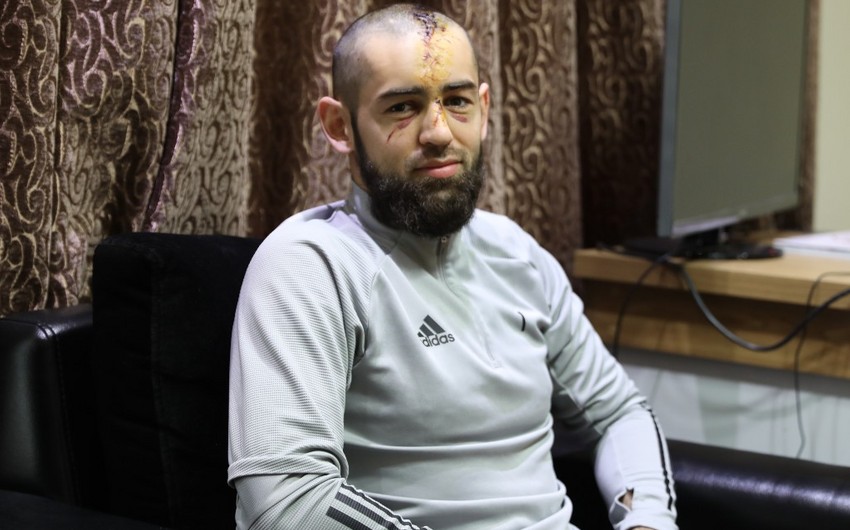 Вратарь Карабаха: Мне на лицо наложено 7 швов, на голову - больше 25