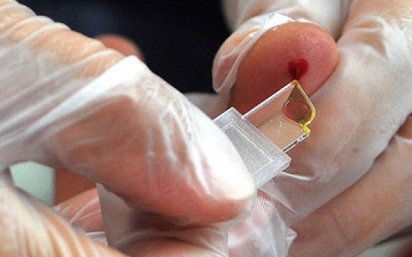 New test uses a drop of blood to reveal entire history of infections