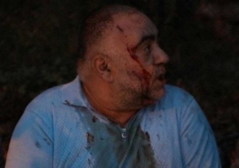 Во время протестов в Армении пострадали десятки человек