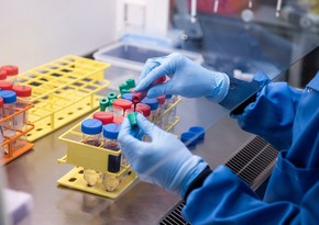 Komitə sədri: “Koronavirus testləri ilə bağlı monopoliyanı aradan qaldırmaq lazımdır”