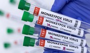 Philippines confirms 2 more active mpox cases