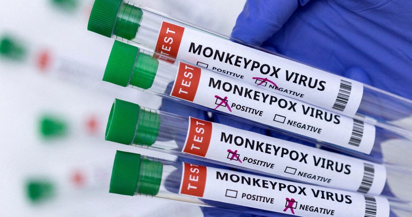 TABIB announces methods of protection against monkeypox 