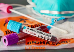 Son sutkada Azərbaycanda 337 nəfər koronavirusa yoluxub, 6 nəfər ölüb
