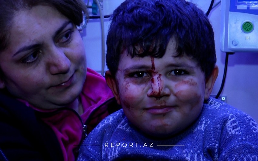 Gəncədə yaralanan uşaq: Daşın altında qaldım