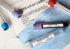 Biochemists develop rapid antibody test for new COVID strains