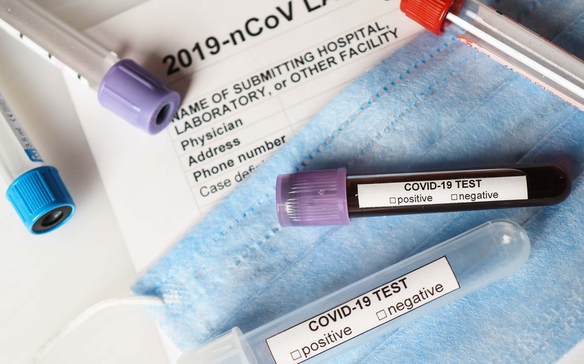 Koronavirusun yeni ştamlarına dair anticisim testi yaradılıb