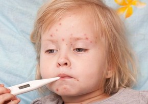 Инфекционист призвала родителей не пренебрегать вакцинацией детей от кори