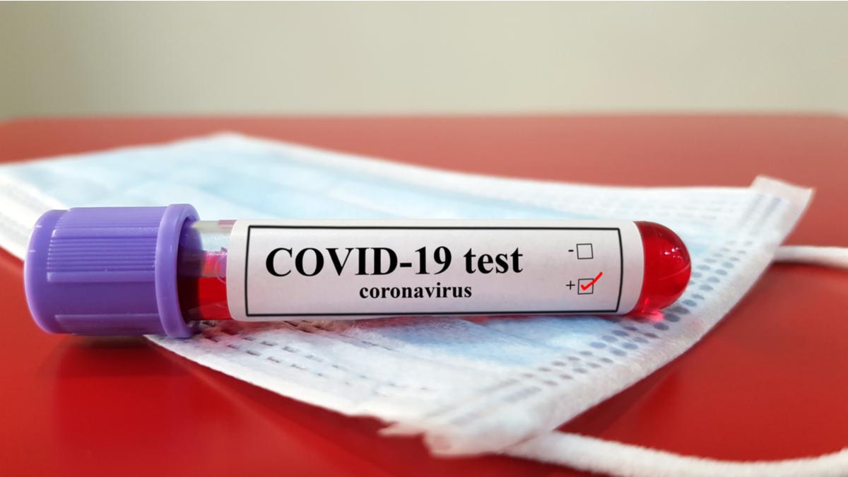 İsraildə 31 313 pasiyent koronavirusdan müalicə olunur