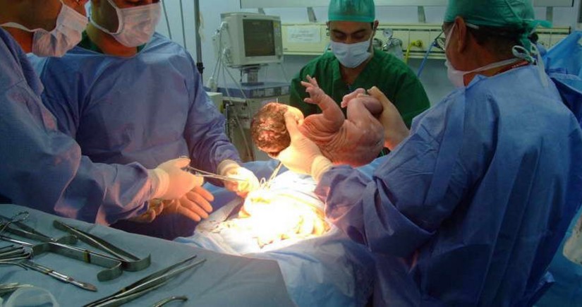 Bakıda əkizlər doğuş zamanı ölüb Bakıda əkizlər doğuş zamanı ölüb