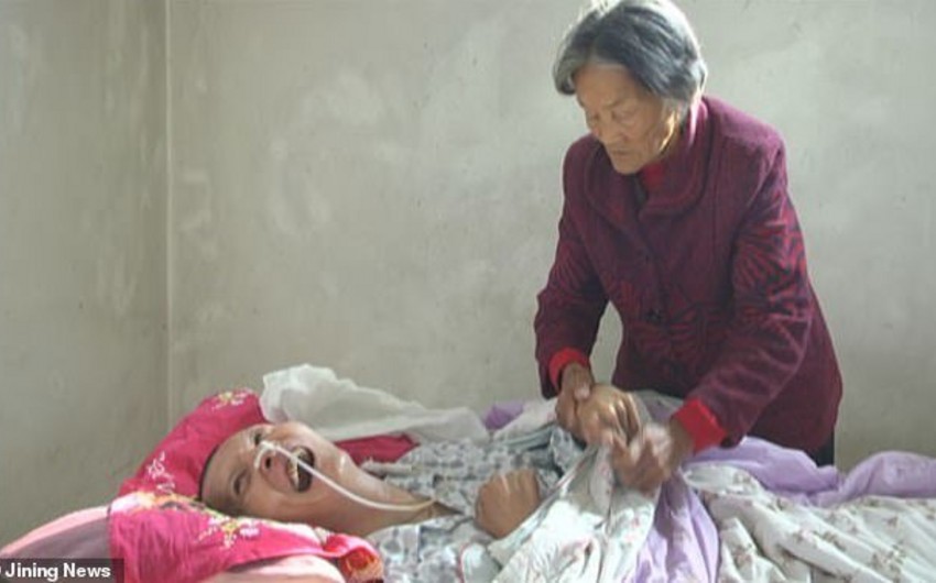 Çində kişi 12 ildən sonra komadan ayılıb