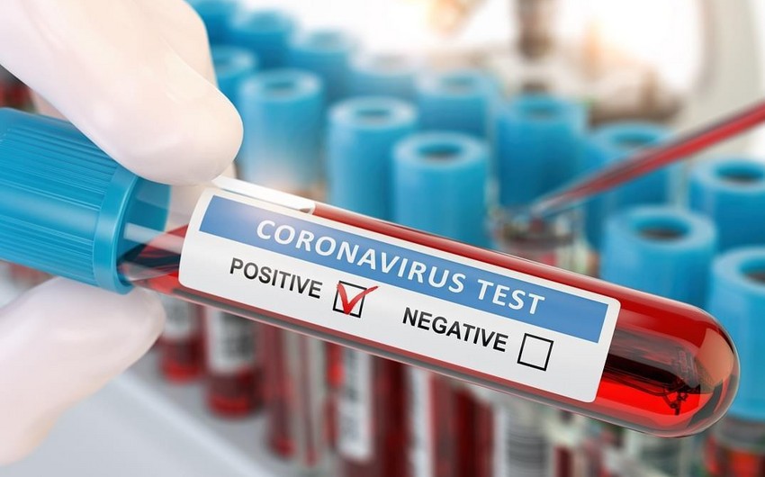 Moldovada daha 304 nəfər koronavirusa yoluxdu