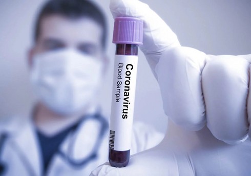 В Азербайджане выявлено 35 новых случаев заражения коронавирусом
